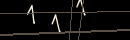 turing